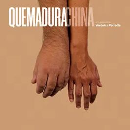 Quemadura china